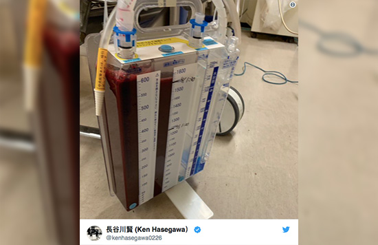 Ken Hsegawa sufre una lesión en lo pulmones después de la derrota ante Aung La N Sang en ONE: A New Era